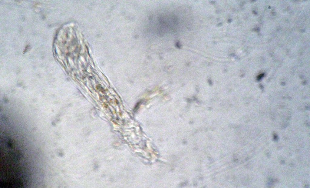 Taphrocampa annulosa: presente in Italia?